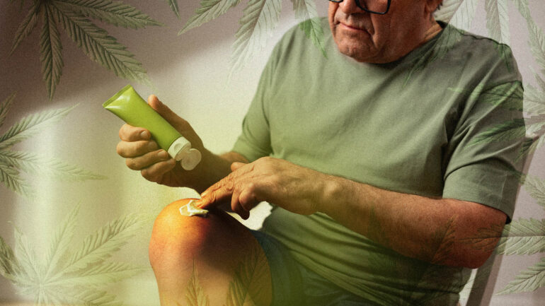 Man applying CBD THC lotion for pain relief